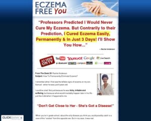 Eczema Totally free You – How to Deal with Eczema Effortlessly, In a natural way and For Very good